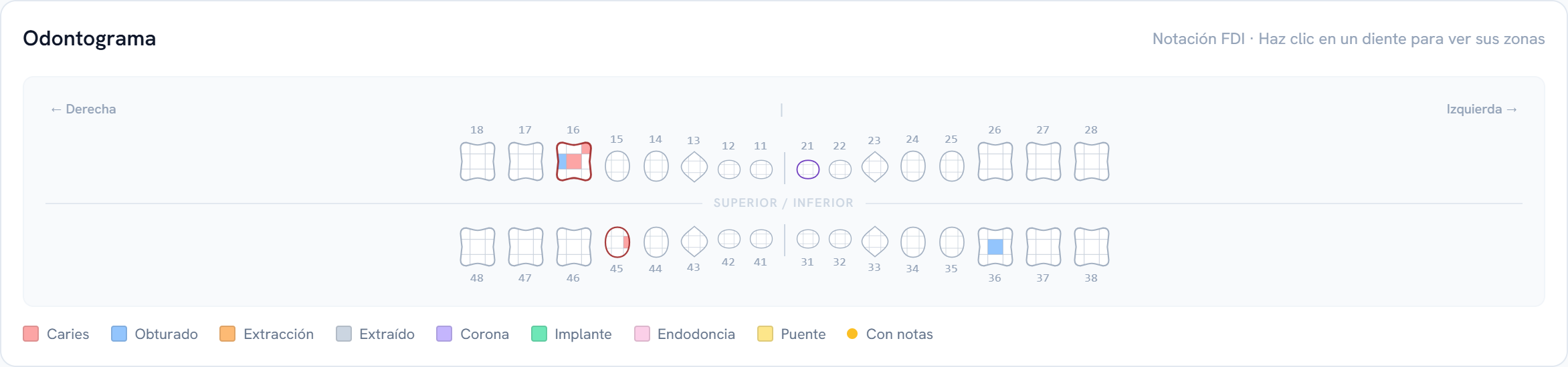 Odontograma con dientes anatómicos y zonas en color